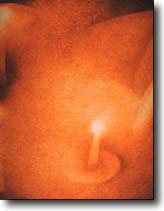 foto9p.jpg (7582 byte)